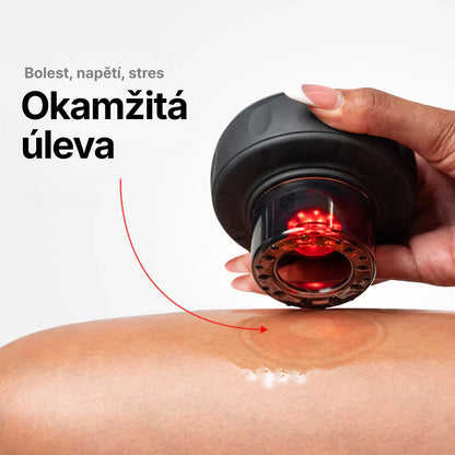 LUREX – Elektrické Vakuové Masážní Baňky
